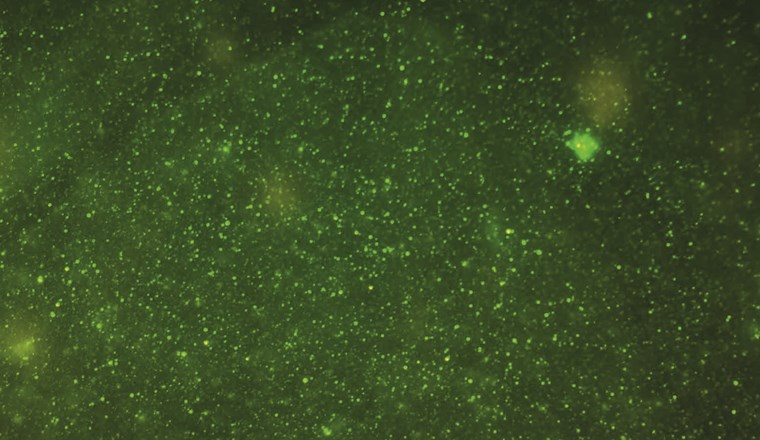 Sind nur grosse Wasserbakterien antibiotikaresistent? Durchflusszytometrie verknüpft mit Molekularbiologie gibt Aufschluss. (©AdobeStock)