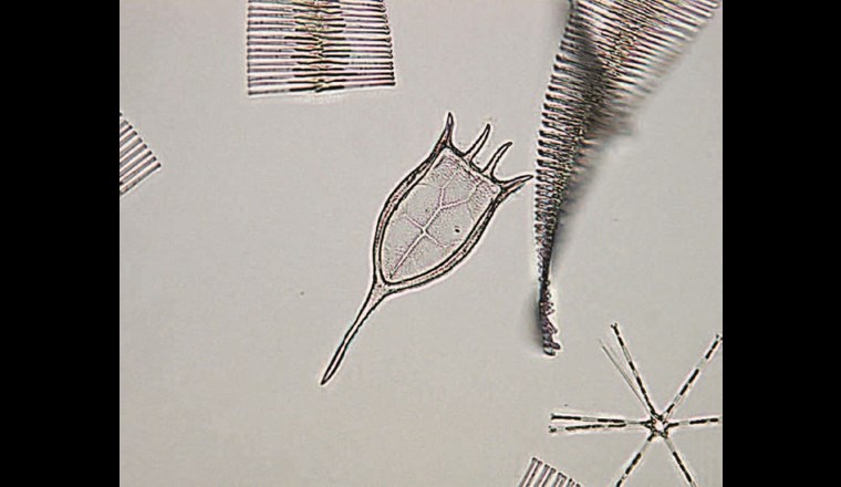 Rädertiere sind genetisch relativ divers und bereiten daher bei der Suche nach geeigneten Primern für das Metabarcoding oft Probleme. Die hier abgebildete Keratella cochlearis wurde jedoch sowohl im Metabarconding als auch in der mikroskopischen Zählung nachgewiesen. (©LUBW)