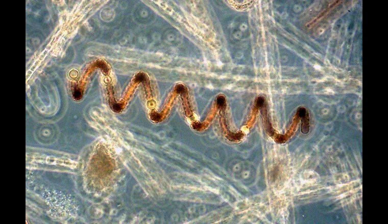Una specie di cianobatteri: Anabeana