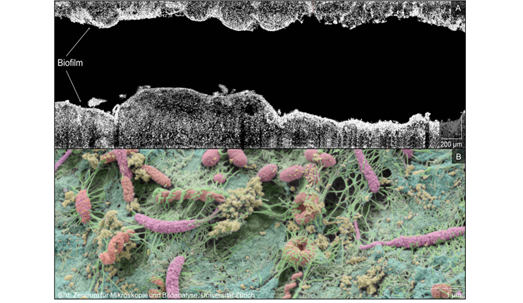Fig. 2 Heterogenität innerhalb von 4 mm eines Duschschlauch-Biofilms. Optische Kohärenztomografie wurde zur Visualisierung und Quantifizierung der räumlichen Heterogenität genutzt (A), Rasterelektronenmikroskopie zur Betrachtung von Bestandteilen und der Zusammensetzung der Biofilmmatrix in höherer Auflösung (B).