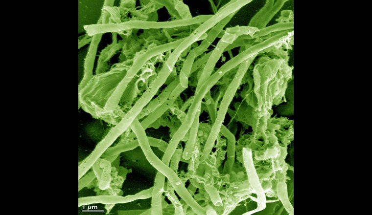 Methanogene Archaeen dienen als Biokatalysator.                         Foto: Electrochaea GmbH   