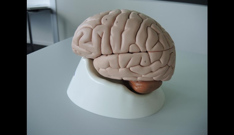 Gehirngerechtes Lernen, ganz plastisch vorgeführt.