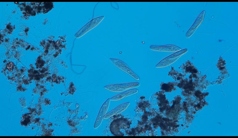 Mit verschiedenen Wimperntierchen wurden Mini-Ökosysteme  erzeugt (Foto: Uni Zürich)