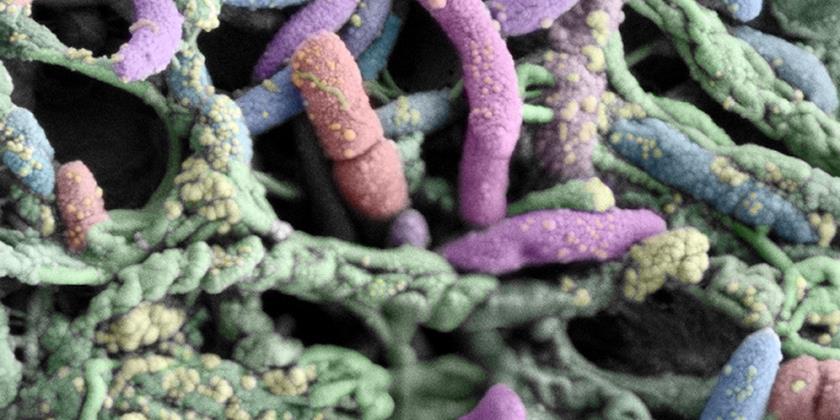 Legionellen: Wie kommen die Krankheitserreger in die Gebäudeinstallationen?  (Bild: Eawag)