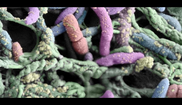 Legionellen: Wie kommen die Krankheitserreger in die Gebäudeinstallationen?  (Bild: Eawag)