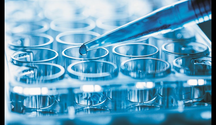 Erste schweizer Screeningstudie zur Erfassung der Toxizität und stofflichen Belastung. (©luchschen/123RF.com)