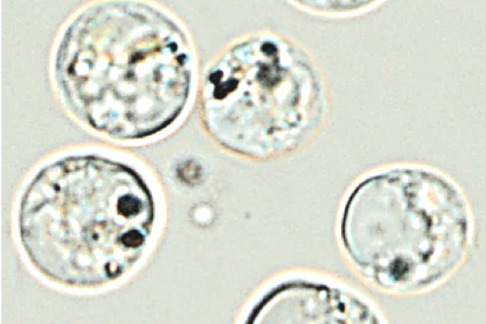 Image de l’absorption de nanoargent par l’algue brune-dorée Poterioochromonas malhamensi, réalisée par microscopie optique.  (© Université de Genève)