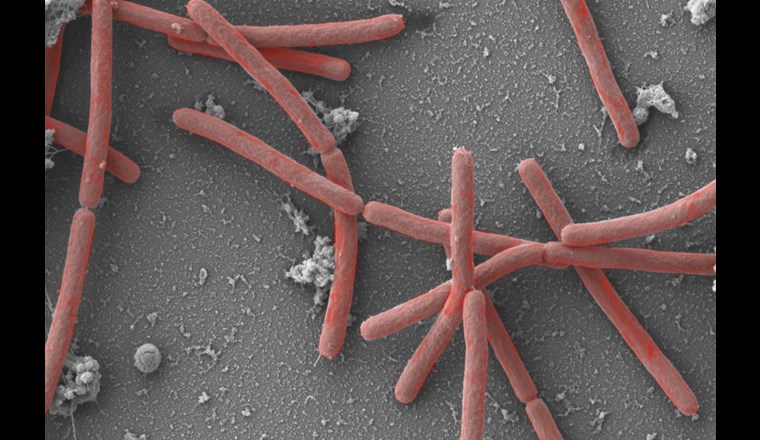 Die Mikrobe des Jahres 2021, Methanothermobacter, 30'000fach vergrössert. (©A. Klingl, München)