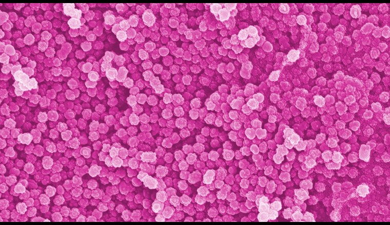 Partikel im Nanometer-Bereich (Elektronenmikroskopische Aufnahme, nachkoloriert, 50 000-fache Vergrösserung) (Bild: Empa / ETH)